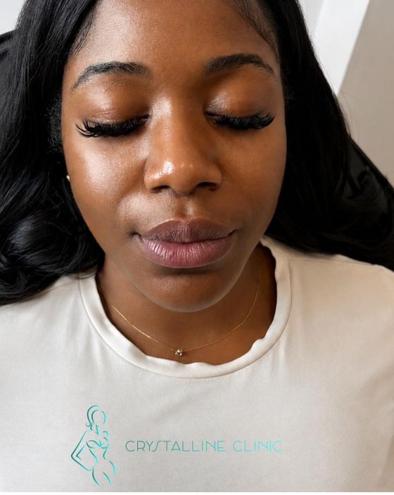 Anti-Wrinkle result