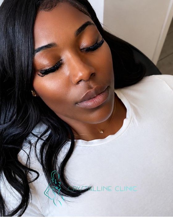 Anti-Wrinkle result