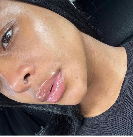 Skin result
