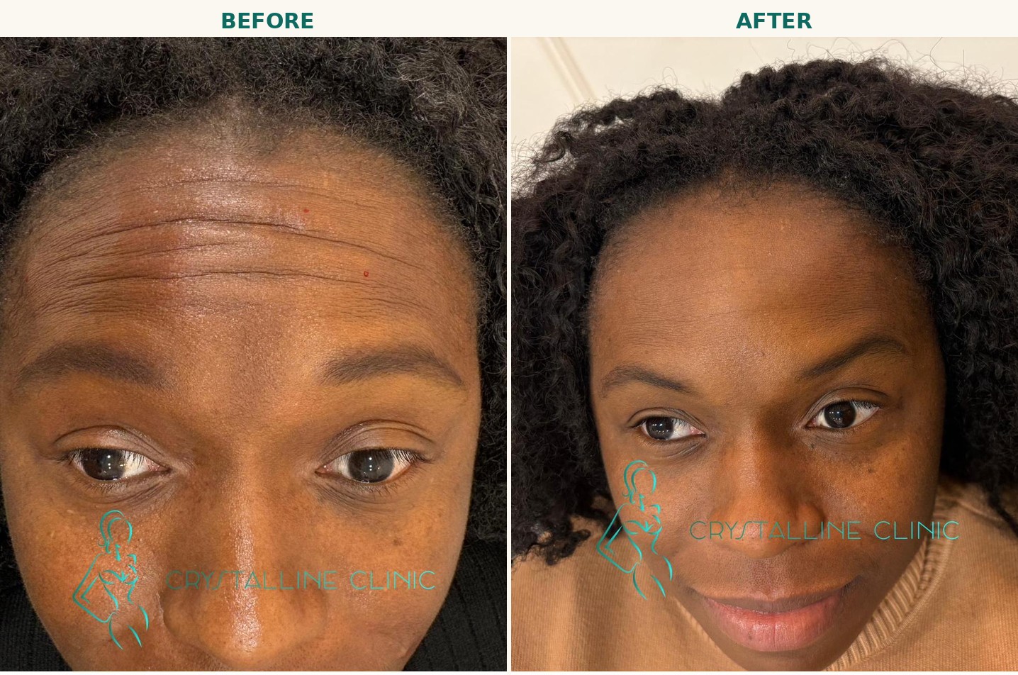Anti-Wrinkle
