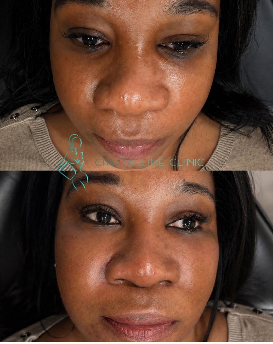 Nurse Liz, founder of Crystalline Clinic
